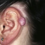 13005_2007_Article_105_Fig5_HTML