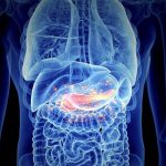 Pancreatitis