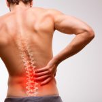 slipped-disc